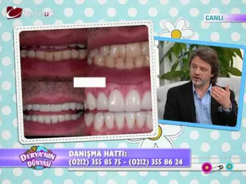 Bad Breath (Halitosis) Causes & Treatment