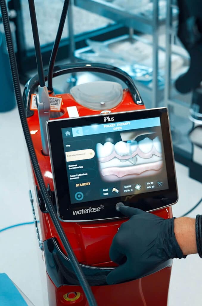 dental work in Turkey